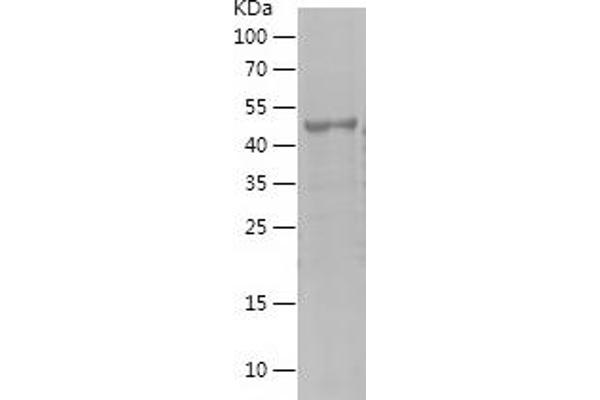 MAGEA1 Protein (AA 161-309) (His-IF2DI Tag)