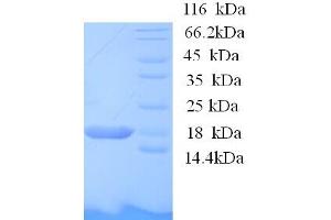 Image no. 1 for BolA-like Protein 1 (BOLA1) (AA 1-137), (full length) protein (His tag) (ABIN5713286)