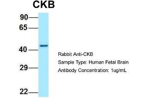 Image no. 1 for anti-Creatine Kinase, Brain (CKB) (C-Term) antibody (ABIN2789613)