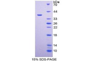 Image no. 1 for Calumenin (CALU) (AA 20-315) protein (His tag) (ABIN1981012)