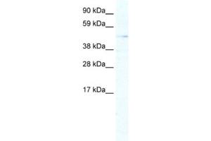 Image no. 1 for anti-Aristaless Related Homeobox (ARX) antibody (ABIN2461424)