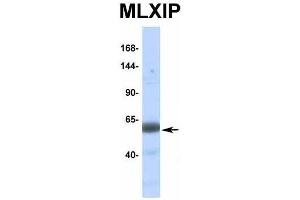 Image no. 2 for anti-MLX Interacting Protein (MLXIP) (Middle Region) antibody (ABIN2776519)
