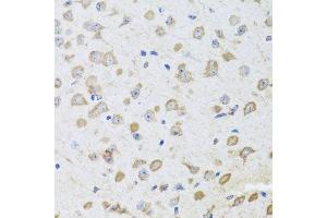 ARL6 antibody  (AA 1-186)