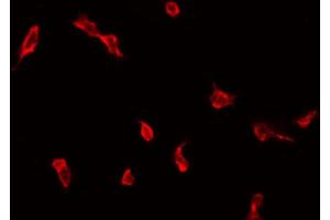 Image no. 1 for anti-Zinc Finger, DHHC-Type Containing 9 (ZDHHC9) (C-Term) antibody (ABIN6261286)