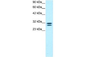 Image no. 2 for anti-HIV-1 Tat Interactive Protein 2, 30kDa (HTATIP2) (N-Term) antibody (ABIN2777583)