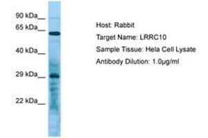 Image no. 1 for anti-Leucine Rich Repeat Containing 10 (LRRC10) (C-Term) antibody (ABIN6750055)