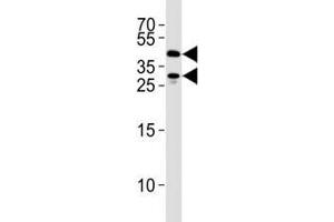 Image no. 3 for anti-Sirtuin 3 (SIRT3) (AA 250-279) antibody (ABIN3032590)