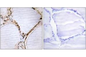 Image no. 2 for anti-BMX Non-Receptor Tyrosine Kinase (BMX) (AA 532-581) antibody (ABIN1532513)