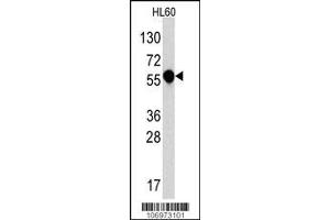 Image no. 2 for anti-Interleukin 1 Receptor, Type I (IL1R1) (AA 474-503), (C-Term) antibody (ABIN390328)