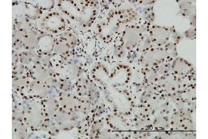 Image no. 2 for anti-E1A Binding Protein P300 (EP300) (AA 731-830) antibody (ABIN560748)