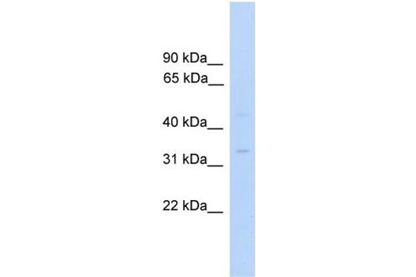 anti-Mitochondrial Methionyl-tRNA Formyltransferase (MTFMT) (C-Term) antibody