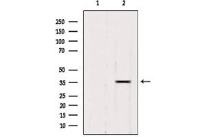 Image no. 1 for anti-RNA-binding protein Raly (RALY) (Internal Region) antibody (ABIN6259086)