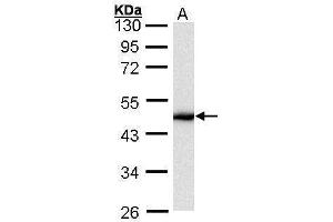 Image no. 2 for anti-Keratin 16 (KRT16) (C-Term) antibody (ABIN2854875)