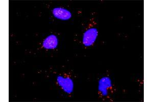 Image no. 2 for anti-Nuclear Factor of kappa Light Polypeptide Gene Enhancer in B-Cells 1 (NFKB1) (AA 860-969) antibody (ABIN561980)