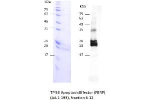 Image no. 2 for TP53 Apoptosis Effector (PERP) (AA 1-193) protein (rho-1D4 tag) (ABIN3085784)
