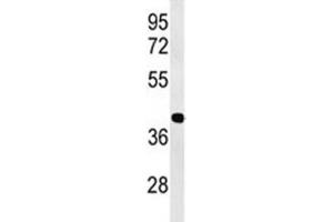 Image no. 3 for anti-Activating Transcription Factor 1 (AFT1) (AA 193-219) antibody (ABIN3029842)