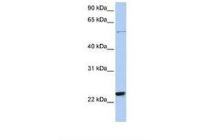 Image no. 1 for anti-Zinc Finger Protein 83 (ZNF83) (N-Term) antibody (ABIN6737783)
