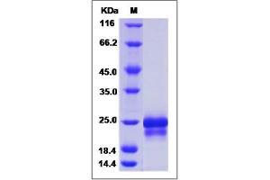Image no. 1 for Prefoldin Subunit 5 (PFDN5) (AA 1-154) protein (His tag) (ABIN2006522)