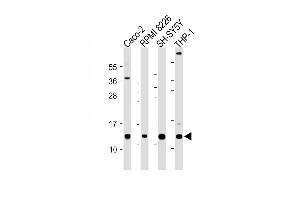 CKS2 anticorps  (AA 43-77)
