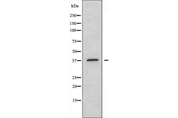 NT5C3 Antikörper  (N-Term)