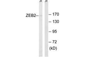 Image no. 1 for anti-Zinc Finger E-Box Binding Homeobox 2 (ZEB2) (AA 71-120) antibody (ABIN1533518)