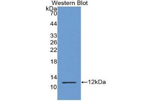 Western Blotting (WB) image for anti-S100 Calcium Binding Protein P (S100P) (AA 1-95) antibody (ABIN3201678)