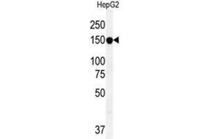 Image no. 2 for anti-ATP-Binding Cassette, Sub-Family C (CFTR/MRP), Member 10 (ABCC10) (AA 774-801), (Middle Region) antibody (ABIN950199)