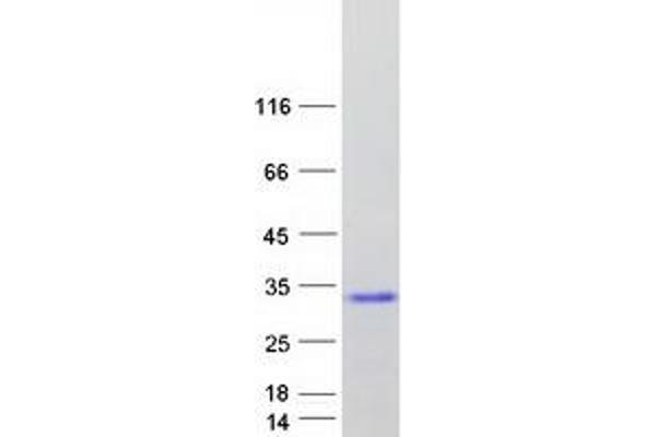 Complexin 4 (CPLX4) protein (Myc-DYKDDDDK Tag)