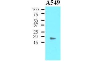 Image no. 1 for anti-Protein Phosphatase 1, Regulatory (Inhibitor) Subunit 14A (PPP1R14A) (AA 1-147) antibody (ABIN933935)