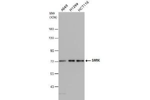 Image no. 3 for anti-SNF Related Kinase (SNRK) (Internal Region) antibody (ABIN2856805)