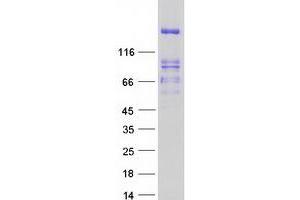 Image no. 1 for Protein tyrosine Phosphatase, Receptor Type, S (PTPRS) (Transcript Variant 4) protein (Myc-DYKDDDDK Tag) (ABIN2730155)