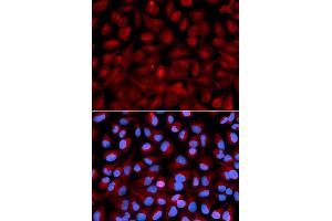 Image no. 5 for anti-Histone Deacetylase 6 (HDAC6) antibody (ABIN3022457)