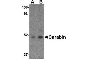 Carabin Antikörper  (C-Term)
