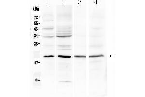 MB antibody  (N-Term)