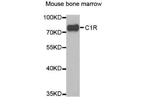 Image no. 1 for anti-Complement Component 1, R Subcomponent (C1R) antibody (ABIN2561500)