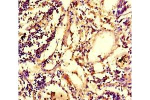 Immunohistochemistry of paraffin-embedded human appendix tissue using ABIN7147801 at dilution of 1:100