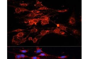 Immunofluorescence analysis of C6 cells using RAB7A Polyclonal Antibody at dilution of 1:100.