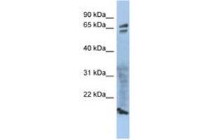 Image no. 1 for anti-Zona Pellucida Glycoprotein 1 (ZP1) (AA 215-264) antibody (ABIN6743944)