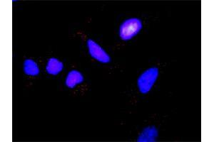 Proximity Ligation Assay (PLA) image for IKBKB & FOXO3 Protein Protein Interaction Antibody Pair (ABIN1339981)