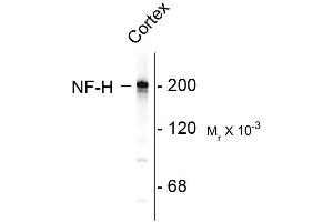 Image no. 1 for anti-Neurofilament, Heavy Polypeptide (NEFH) antibody (ABIN361350)