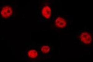 Image no. 3 for anti-Aristaless Related Homeobox (ARX) (Internal Region) antibody (ABIN6257677)