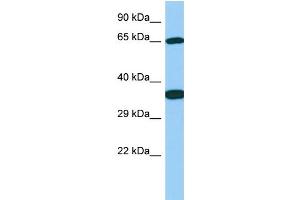 Image no. 1 for anti-UDP-N-Acetyl-alpha-D-Galactosamine:polypeptide N-Acetylgalactosaminyltransferase 13 (GalNAc-T13) (GALNT13) (C-Term) antibody (ABIN2773960)