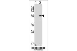 Western Blotting (WB) image for anti-DEAD (Asp-Glu-Ala-Asp) Box Polypeptide 39A (DDX39) antibody (ABIN2160540)