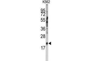 Image no. 1 for anti-Small Nuclear Ribonucleoprotein Polypeptide C (SNRPC) antibody (ABIN3001664)