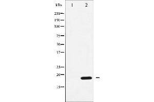 Image no. 3 for anti-Protein Phosphatase 1, Regulatory (Inhibitor) Subunit 14A (PPP1R14A) (pThr38) antibody (ABIN6256551)