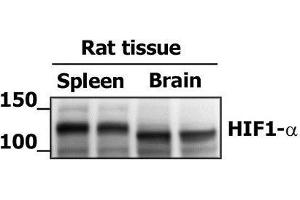 Image no. 3 for anti-Hypoxia Inducible Factor 1, alpha Subunit (Basic Helix-Loop-Helix Transcription Factor) (HIF1A) (AA 351-400) antibody (ABIN672546)