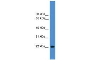 Image no. 1 for anti-Nudix (Nucleoside Diphosphate Linked Moiety X)-Type Motif 16-Like 1 (NUDT16L1) (AA 78-127) antibody (ABIN6745492)