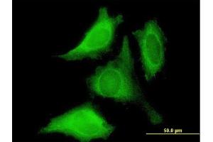 Immunofluorescence of purified MaxPab antibody to PROK1 on HeLa cell.