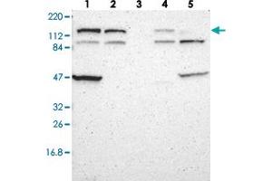 Image no. 2 for anti-Diaphanous Homolog 2 (DIAPH2) antibody (ABIN5576602)