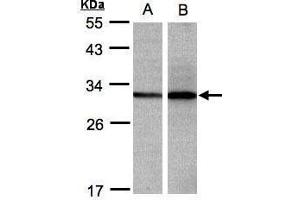 Image no. 2 for anti-Enoyl-CoA Delta Isomerase 1 (ECI1) (Center) antibody (ABIN2855835)